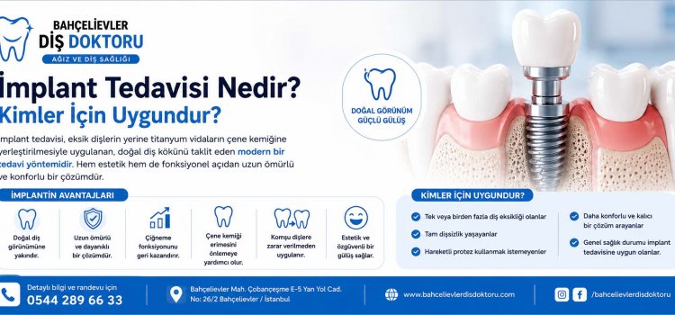 İmplant Tedavisi Nedir? Kimler İçin Uygundur?