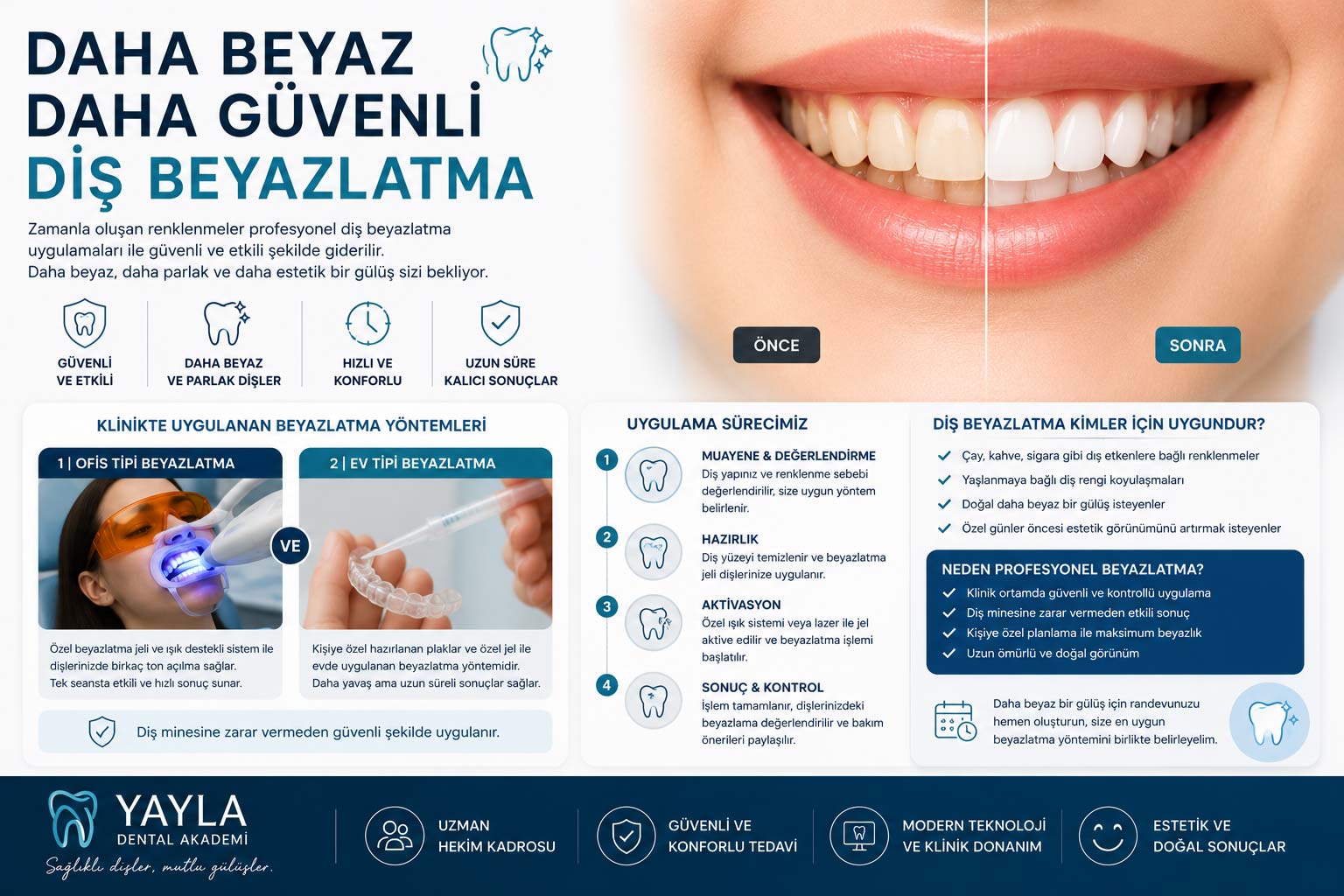 Diş Beyazlatma