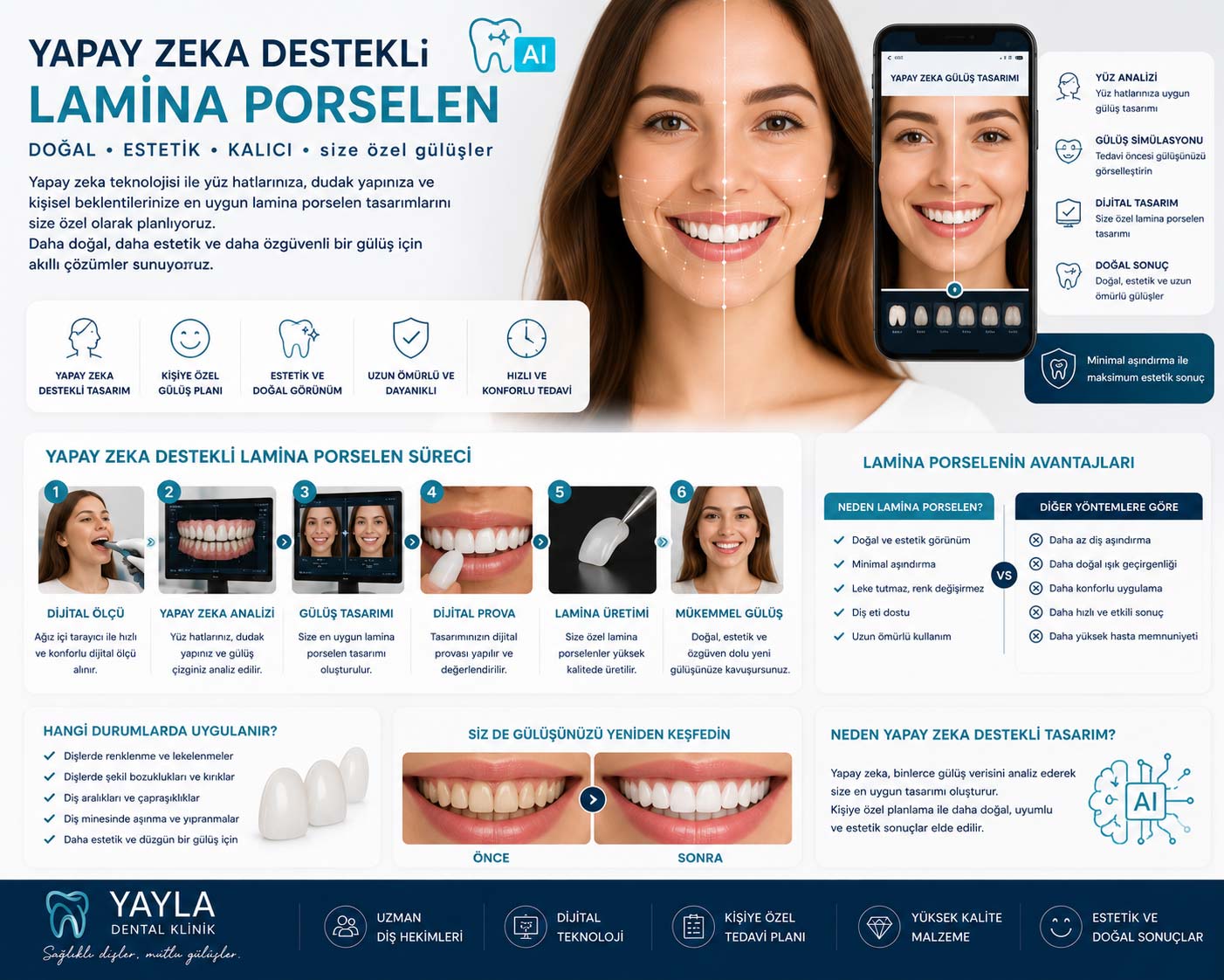 Yapay Zeka Destekli Lamina Porselen