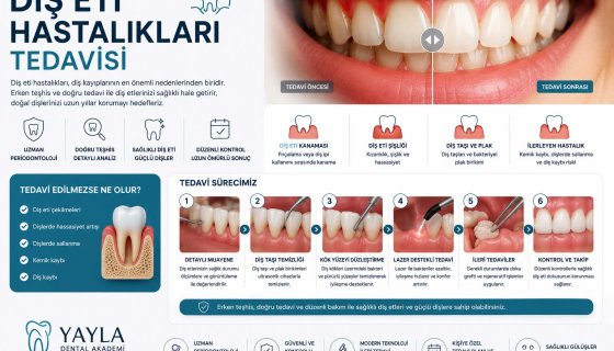 Diş Eti Hastalıkları Tedavisi